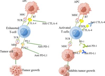 Research progress of targeted therapy combined with immunotherapy for hepatocellular carcinoma